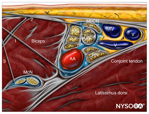 axillary-injection