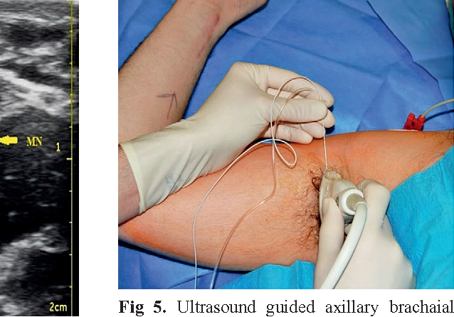 axillary-position