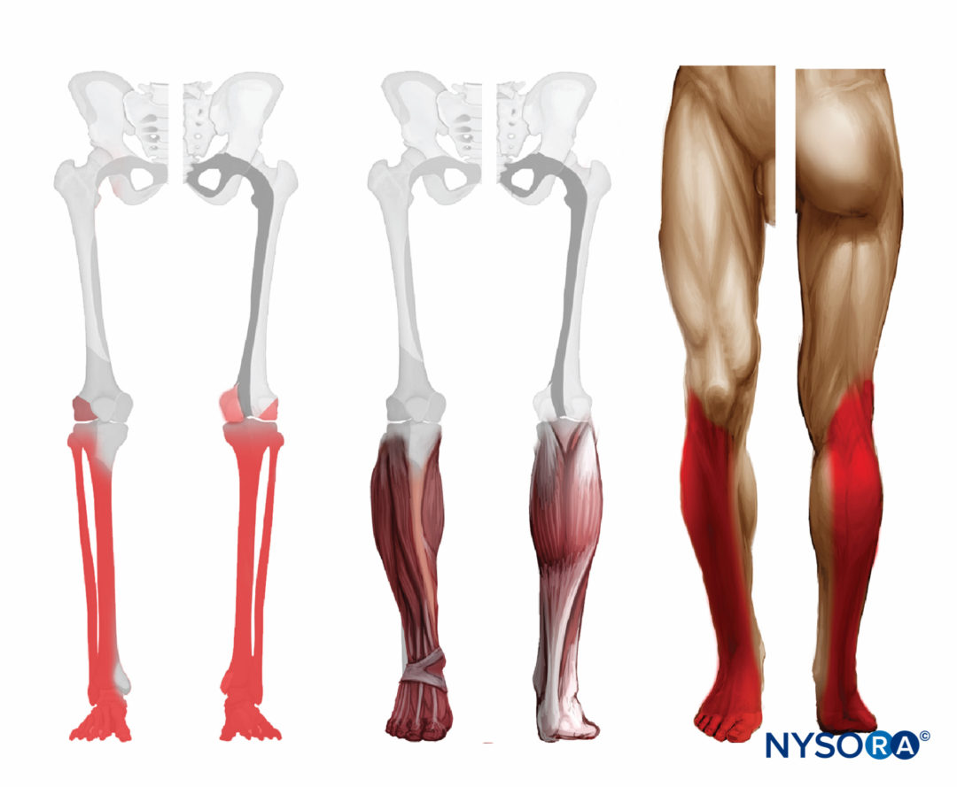 popsci-dermatome